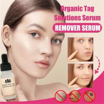 Organic Mole and Tag / Spots Remover Serum
