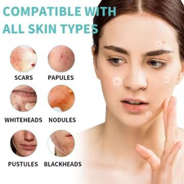 36Pcs Original Korean Anti-Acne Patches
